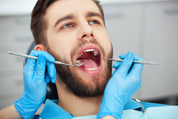 a man with his mouth wide open during a dental check-up